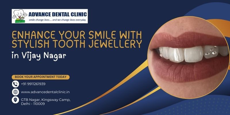 Enhance Your Smile With Stylish Tooth Jewellery In Vijay Nagar